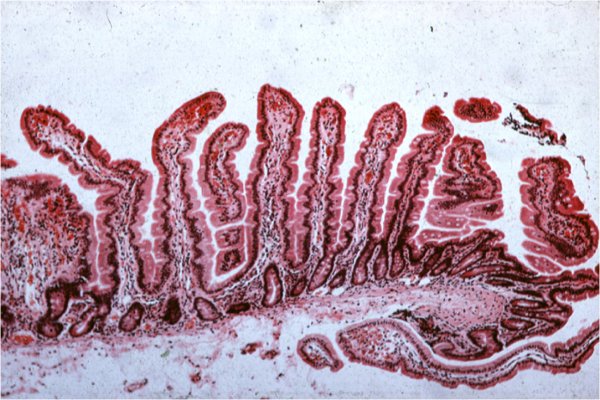 photo of normal small intestine